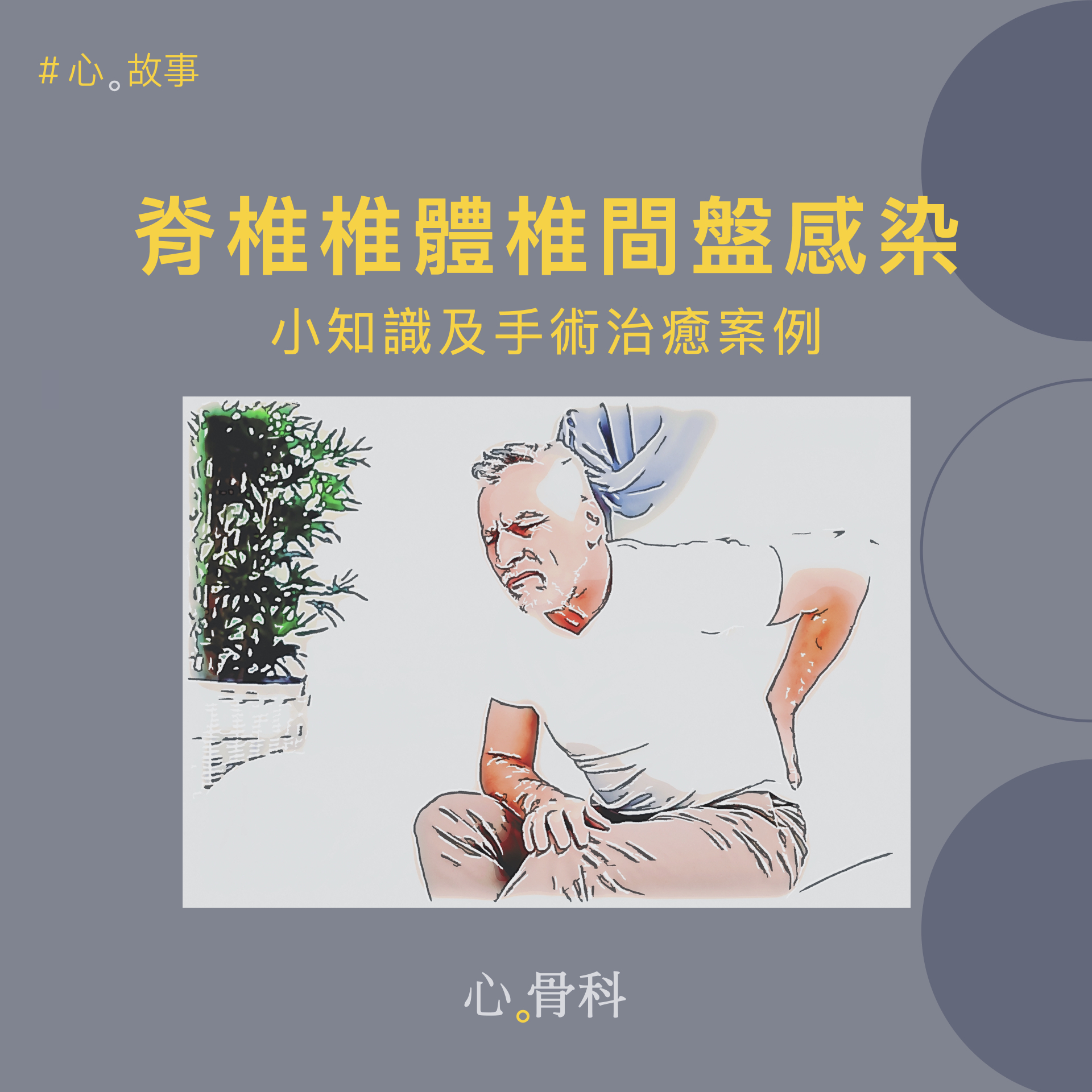 脊椎內視鏡手術：脊椎椎體椎間盤感染小知識及手術治癒案例