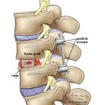 林俊傑病變？！微創內視鏡手術，解決「鄰近節病變」的新選擇！